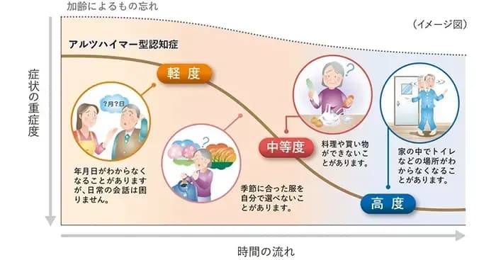 アルツハイマー型認知症の経過