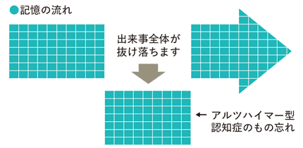 アルツハイマー型認知症のもの忘れ
