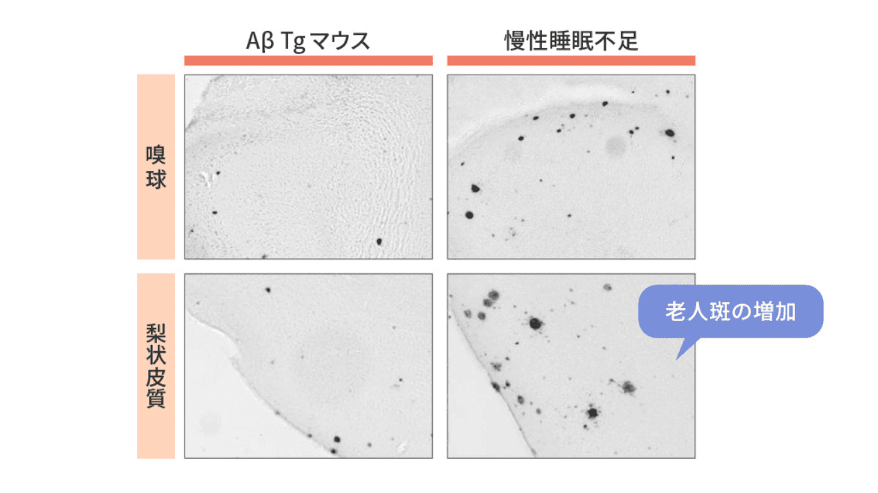 アミロイドβを発現させたマウスの実験