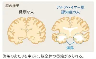 brain1.png