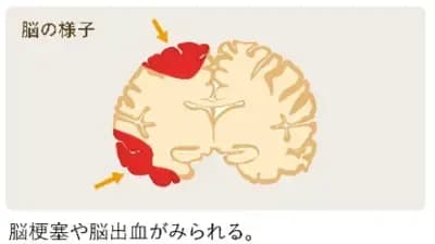 brain2.png
