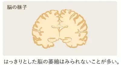 brain3.png