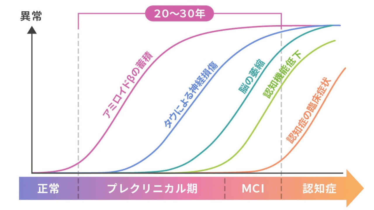 アルツハイマー病の進行