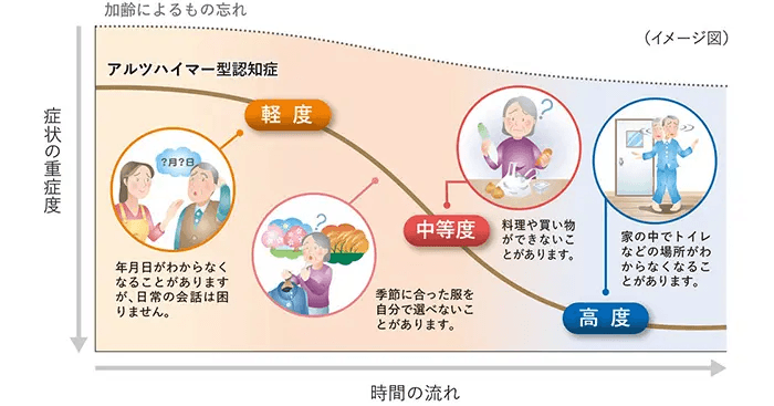 アルツハイマー型認知症の経過