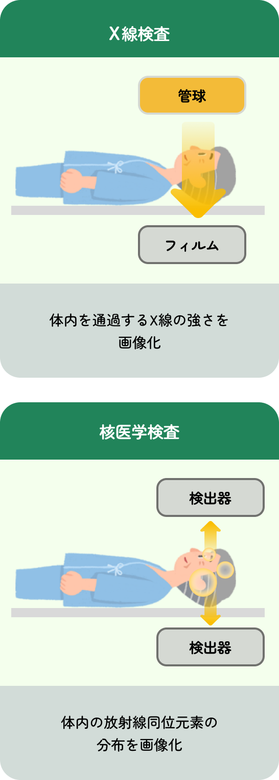 核医学検査とX線検査の違いを比較した図。X線検査では、体内を通過するX線の強さを画像化しますが、核医学検査では、体内の放射線同位元素の分布を画像化します。