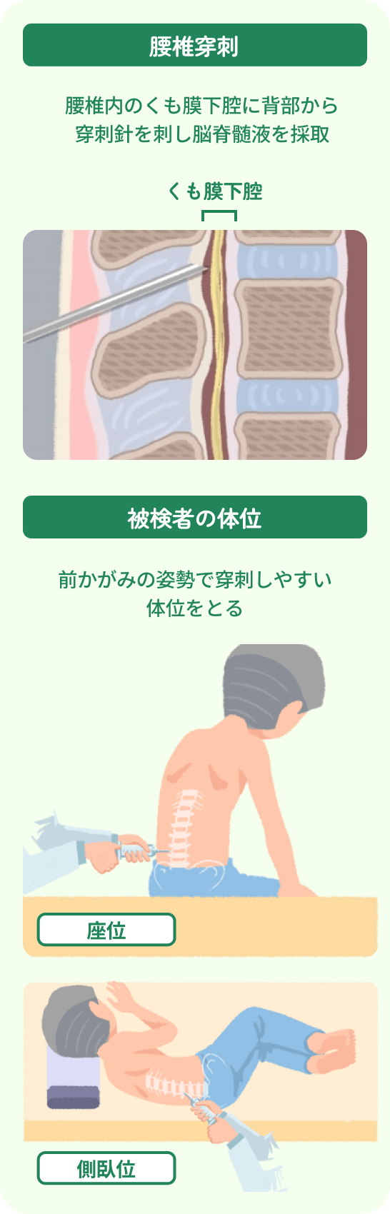 腰椎穿刺：腰椎内のくも膜下腔に背部から穿刺針を刺し脳脊髄液を採取。被検者の体位：前かがみの姿勢で穿刺しやすい体位をとる。体位は、座位や側臥位などがある。